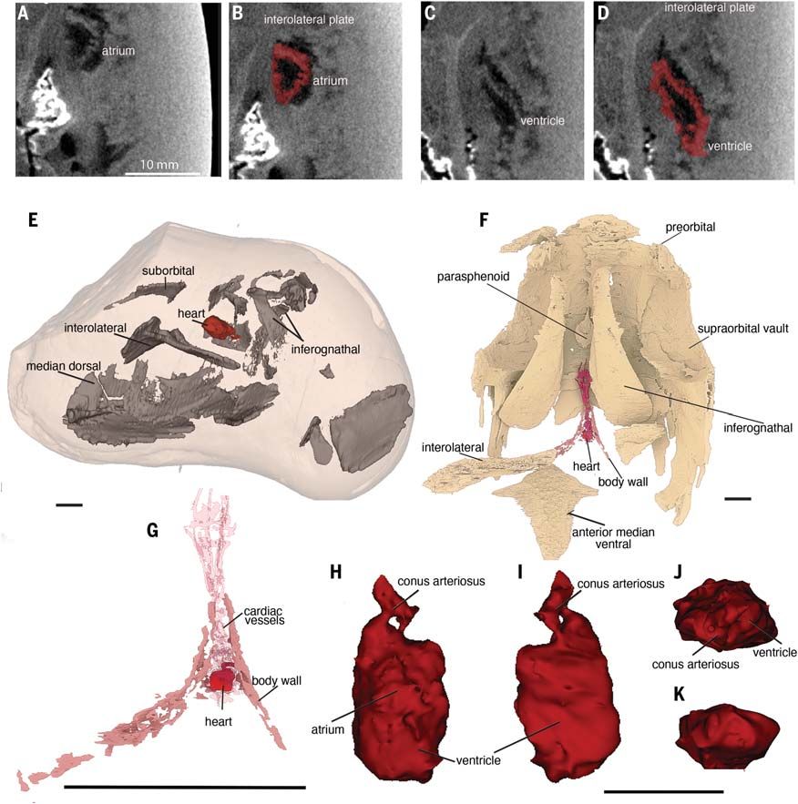 The scan revealed incredible details about the heart, including ventricles and atria. (Trinajstic et al., Science, 2022)