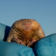 Confirming these rare moles are still alive means we can better protect the few habitats where they can still be found